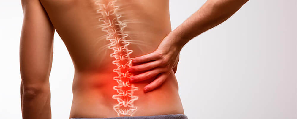 Bolovi u leđima - Lumbago